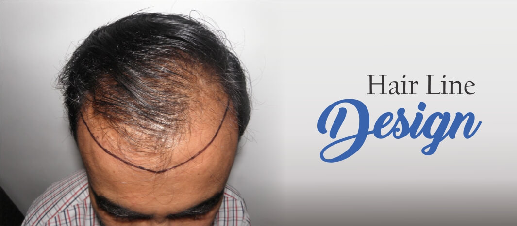 Regain Hair Clinic Hair Line Design Regain Hair Line Design